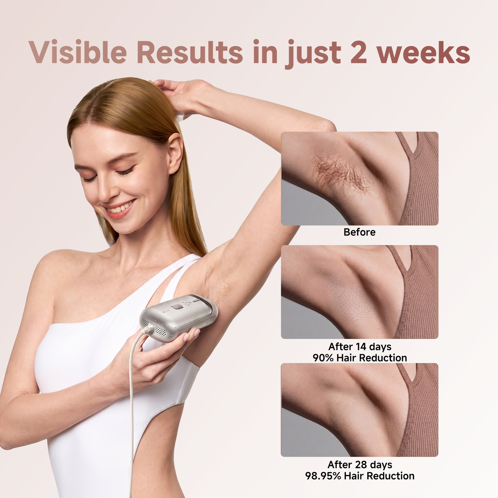 Dreame Nova IPL Hair Removal Device